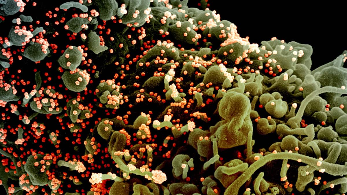 Le bilan de la COVID comparé à d'autres virus mortels