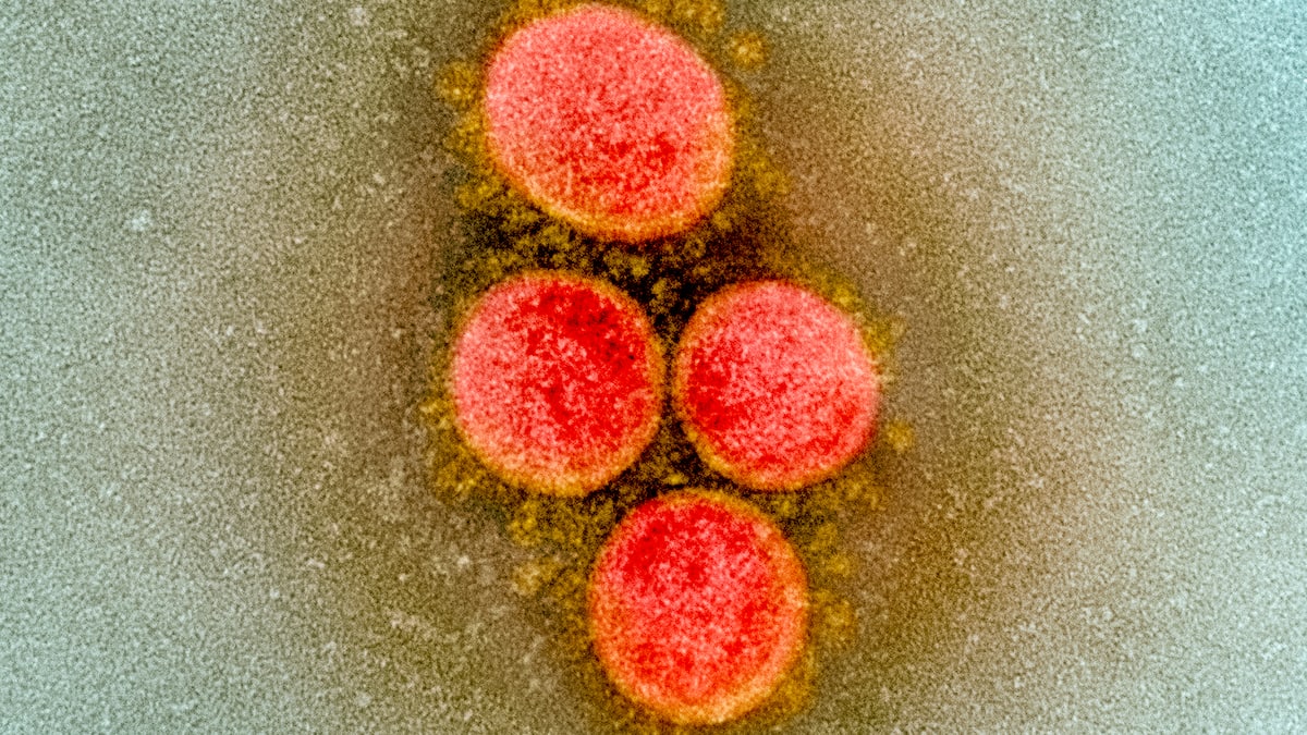 Because of the delta variation, vaccines only protect 40% of transmissions Because of the delta variation, vaccines only protect 40% of transmissions