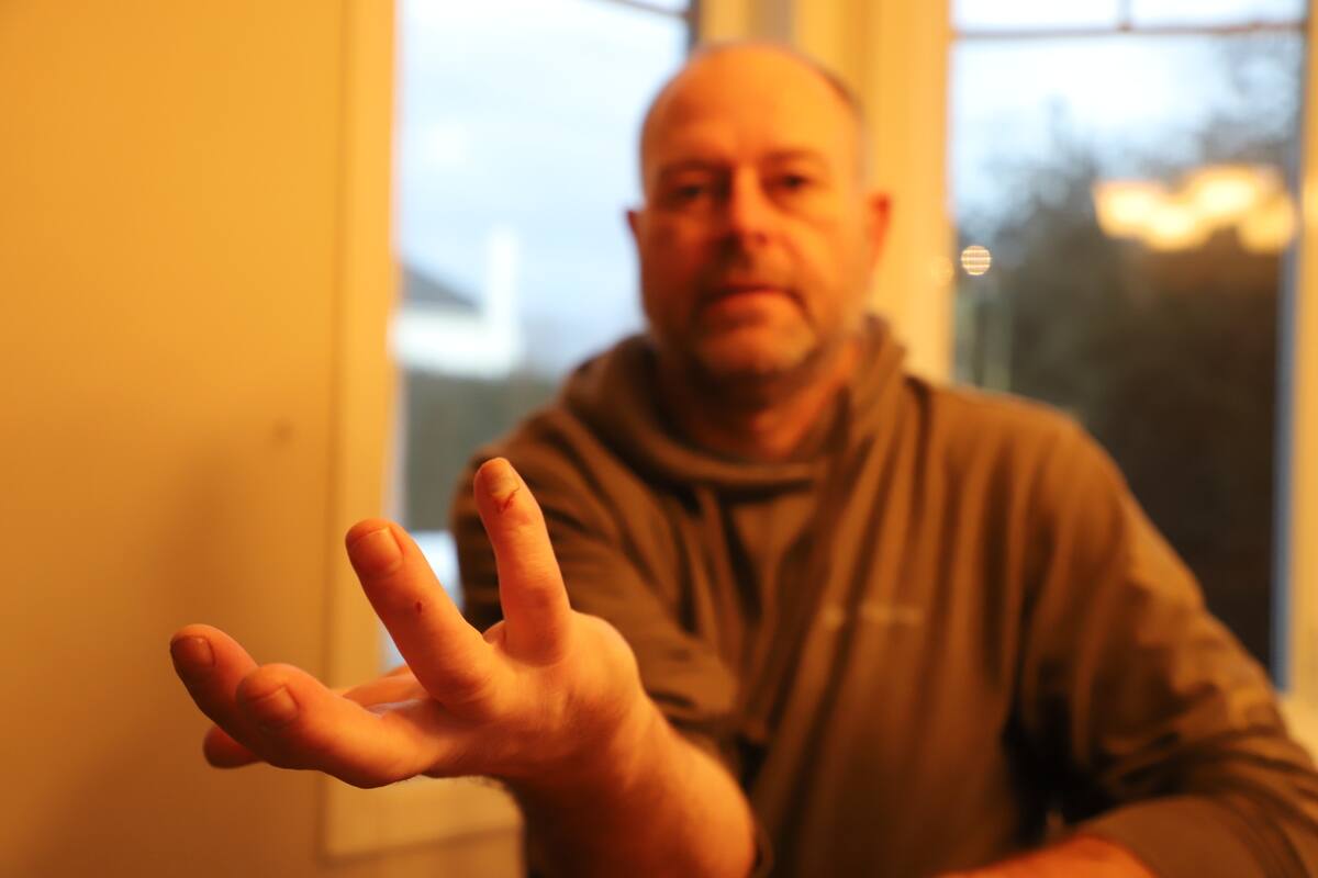 &laquo;C&rsquo;est dur pour le moral&raquo;: amput&eacute; apr&egrave;s un accident, la SAAQ refuse de l&rsquo;indemniser