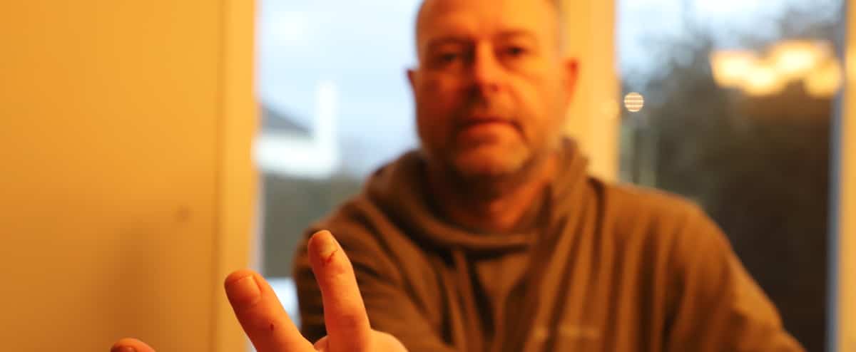 «C’est dur pour le moral»: amputé après un accident, la SAAQ refuse de l’indemniser