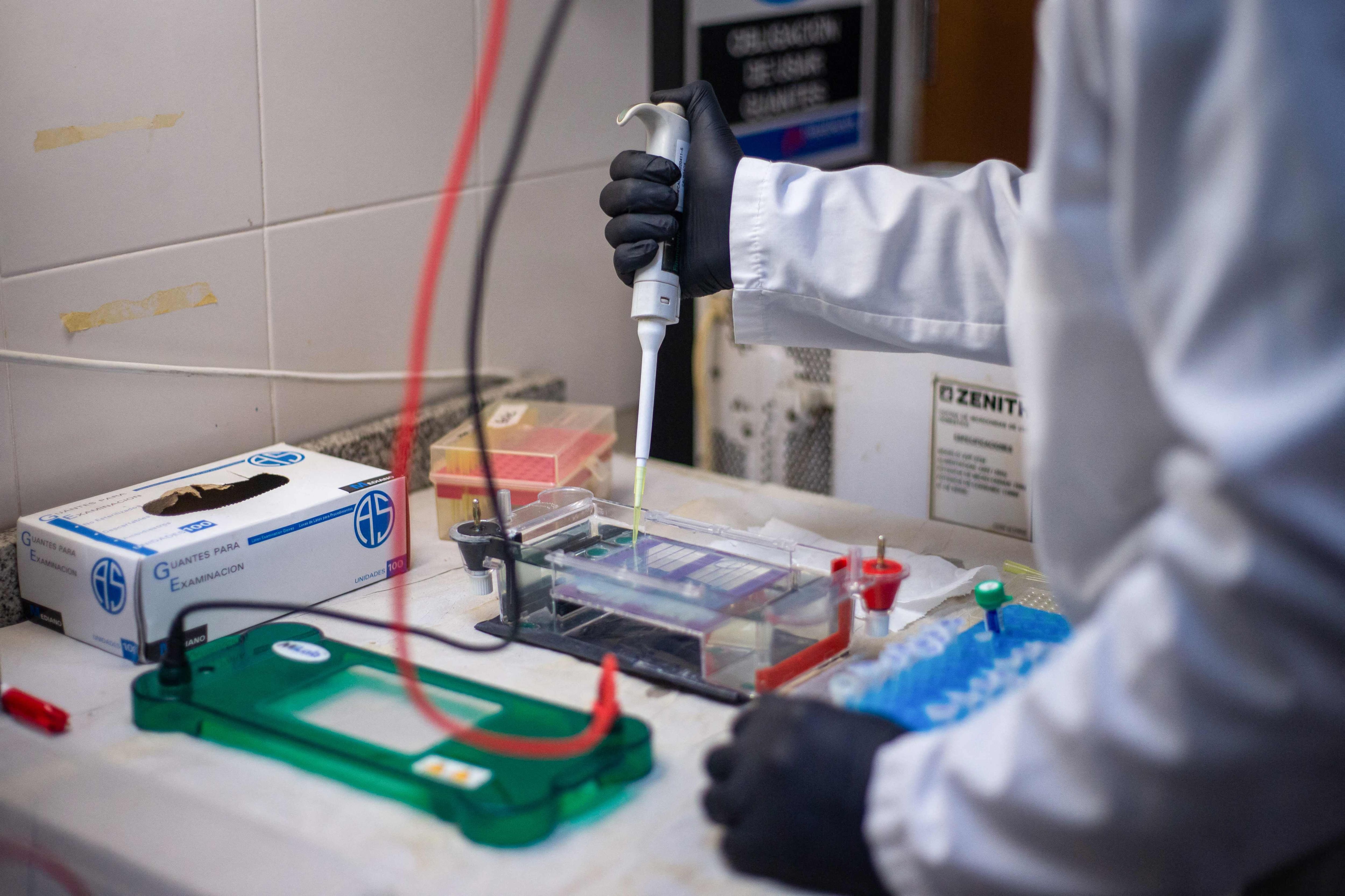 Éclosion de hantavirus: un expert relativise le taux de mortalité