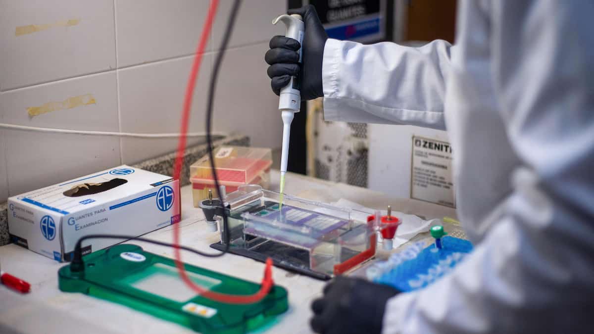 Éclosion de hantavirus: un expert relativise le taux de mortalité
