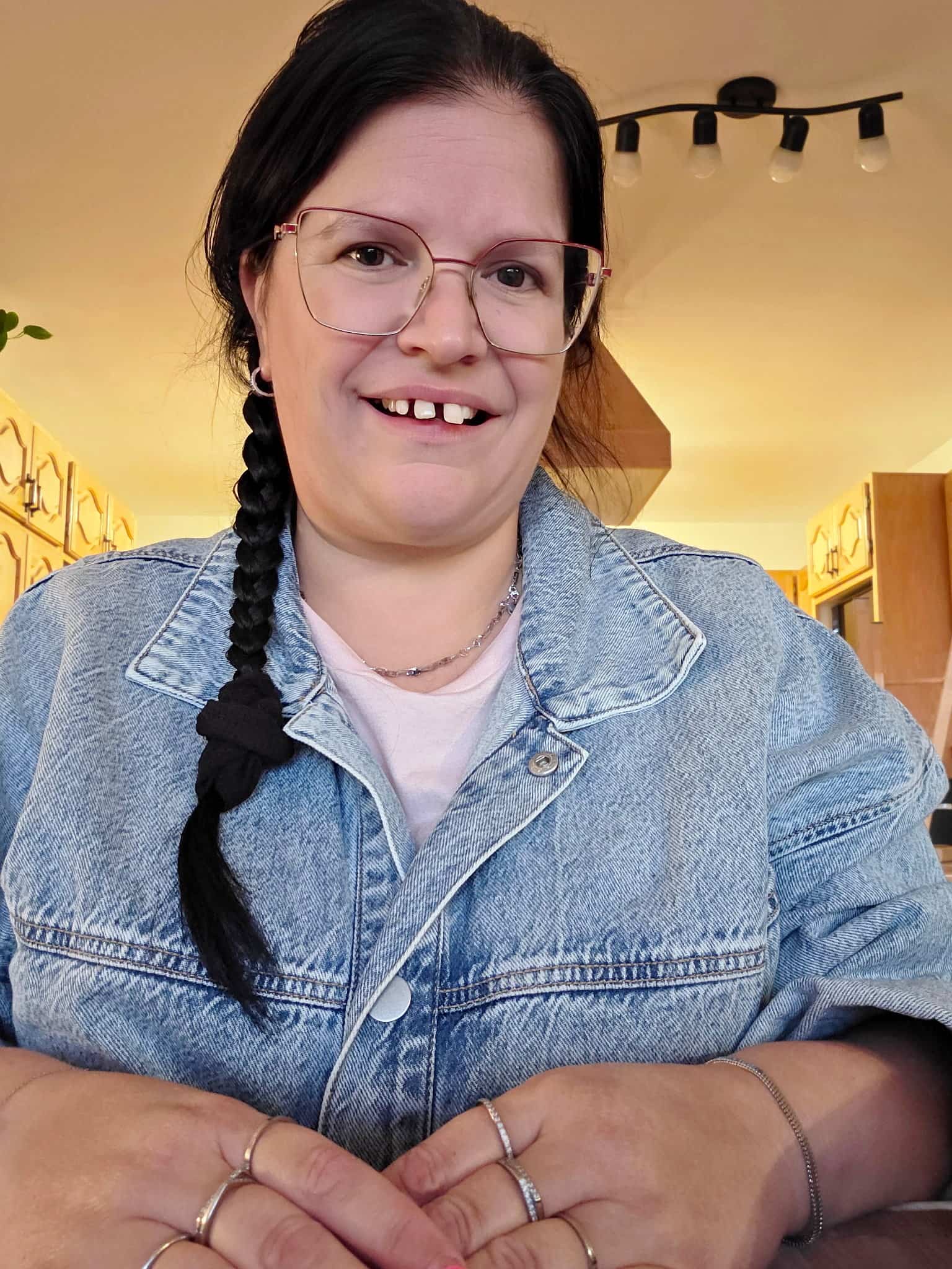 «Ce n’est pas du luxe ou de la coquetterie» : elle doit payer 55 000 $ pour ne pas devenir édentée à 43 ans