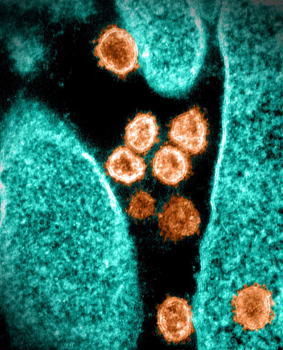 Nouvelle &eacute;quipe de &laquo;traqueurs&raquo; de virus et pathog&egrave;nes