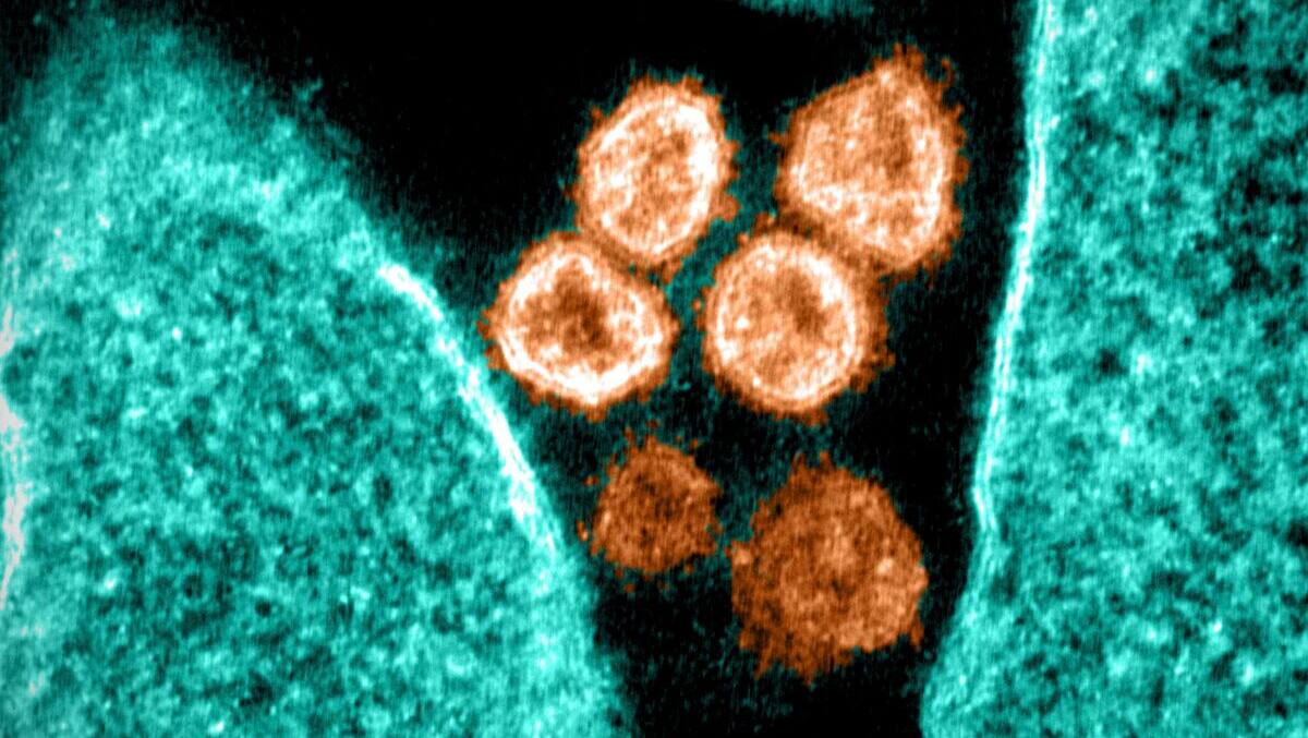 Nouvelle équipe de «traqueurs» de virus et pathogènes