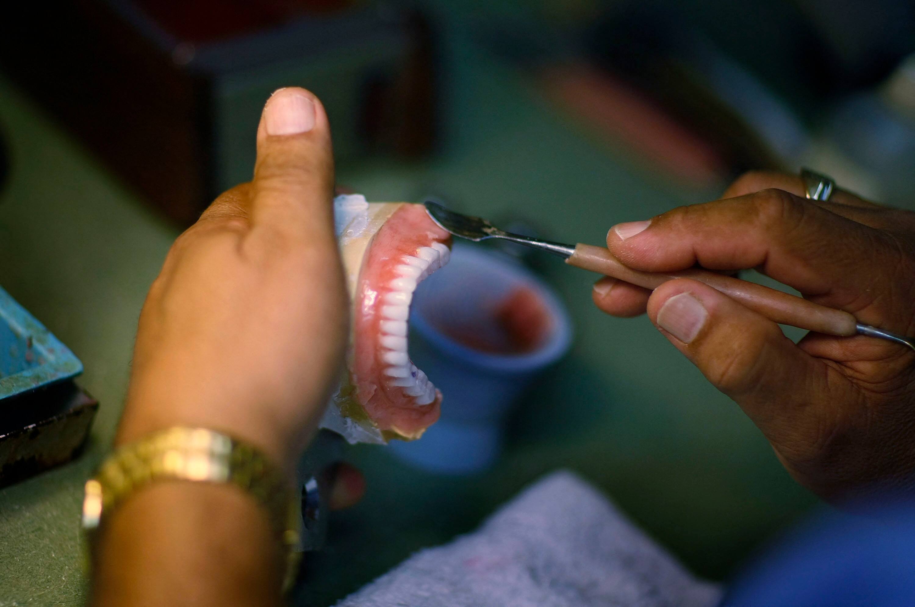 Un Britannique r&eacute;cup&egrave;re un dentier perdu 11 ans plus t&ocirc;t en Espagne