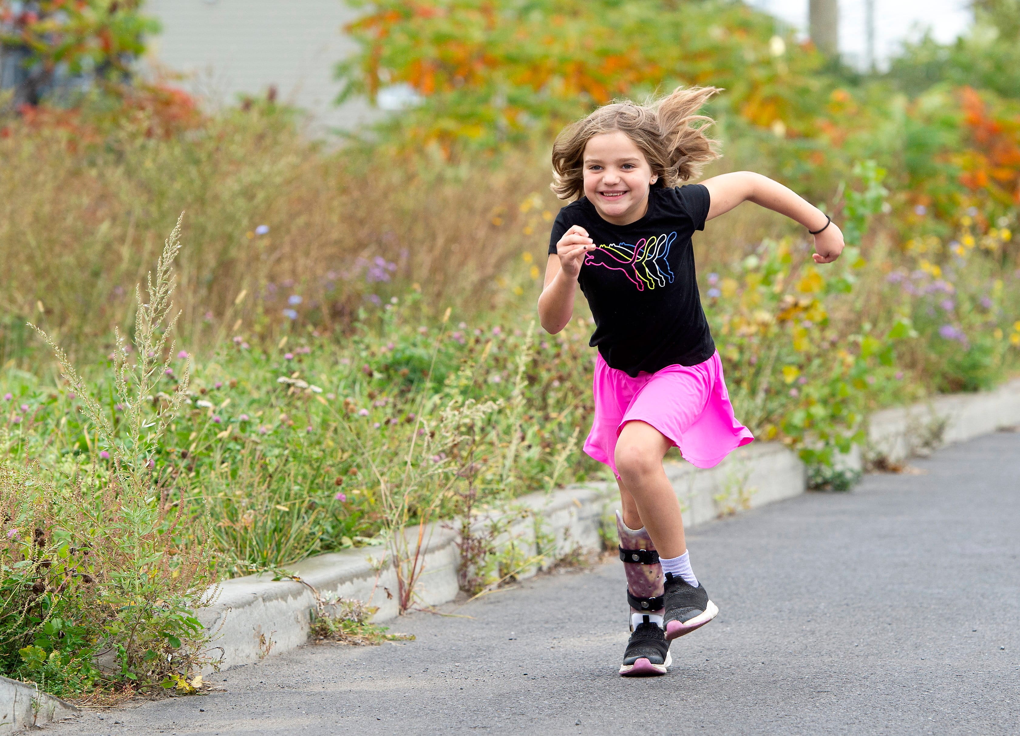 «Regarde mes cicatrices!»: une fillette de 6 ans peut courir après trois grosses chirurgies