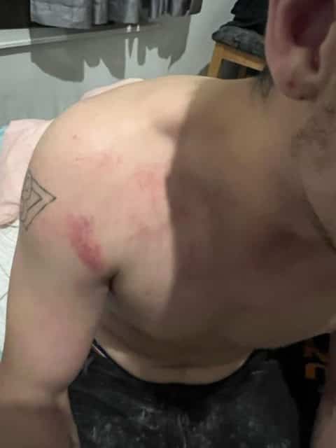 According to the doctor's report, obtained by Le Journal, Frédérick Dubois suffered a concussion and several injuries to the face, shoulder and wrist during the police intervention of the SPVQ.