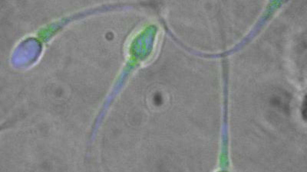 Variole du singe dans le sperme: «ni rare ni aléatoire»