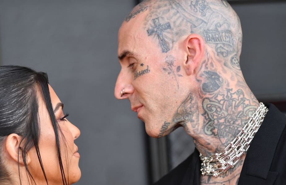 Image principale de l'article On sait maintenant de quoi souffre Travis Barker