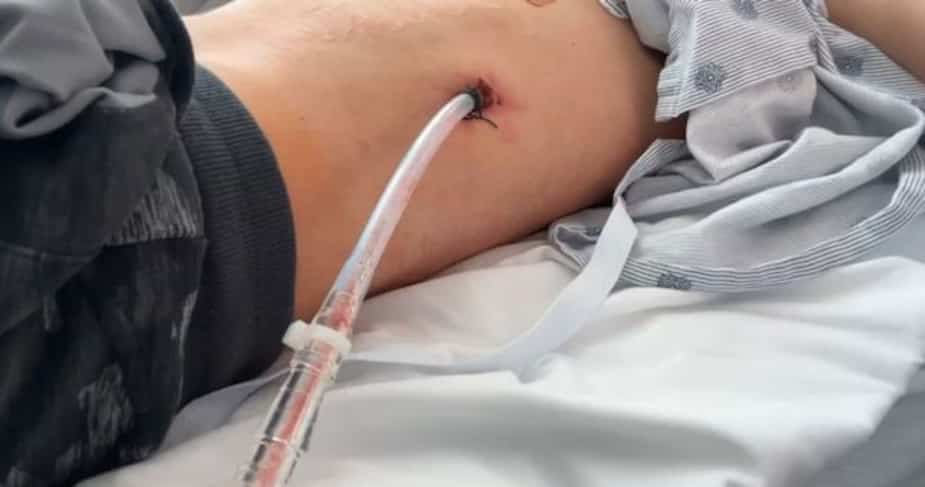 Accro la vapoteuse 19 ans, ses poumons l'ont lch 4 fois | 24 heures Accro la vapoteuse 19 ans, ses poumons l'ont lch 4 fois | 24 heures
