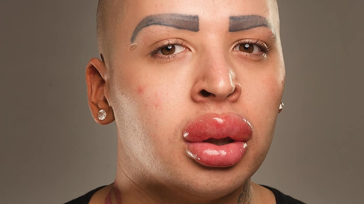 Télé-prescription | Pour apprendre à accepter son corps | 7 Jours