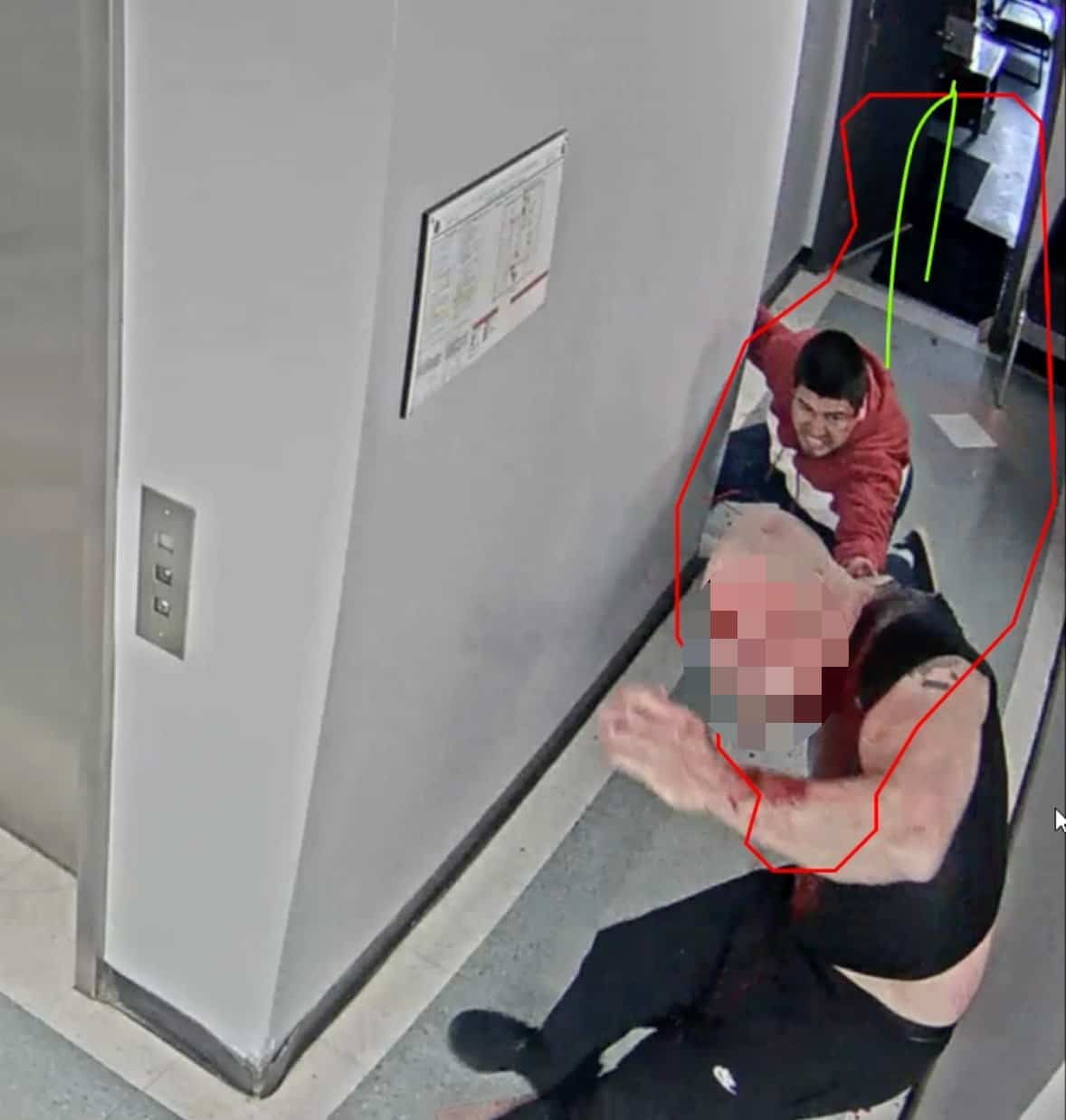 Poignardée à coups de ciseaux dans le cou, la victime a perdu deux litres de sang