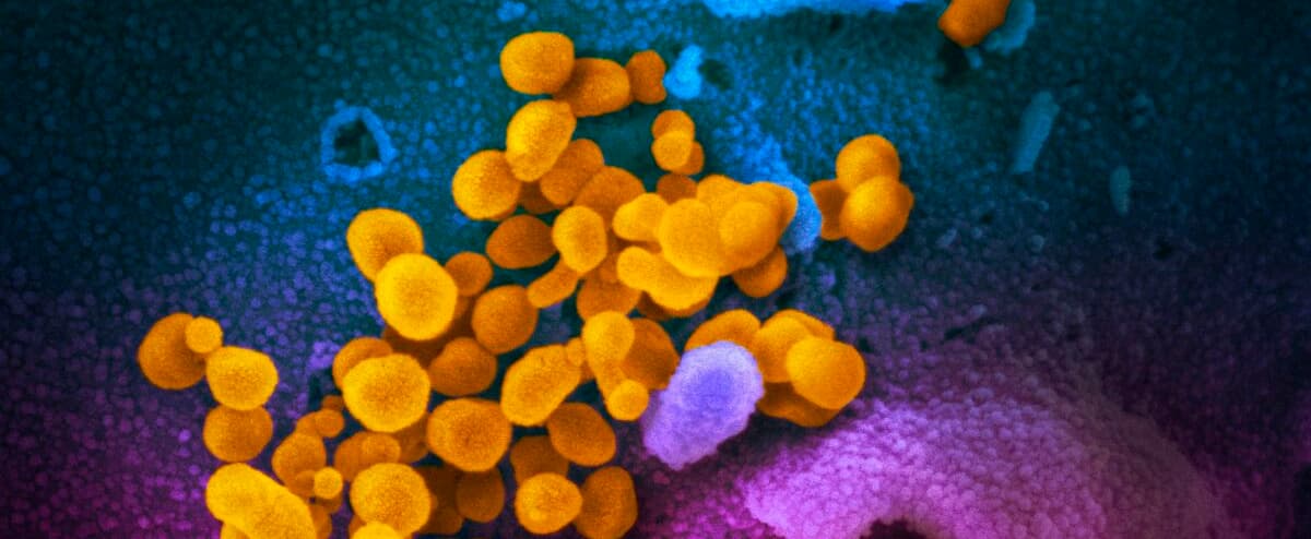 COVID-19 could also make you deaf 1