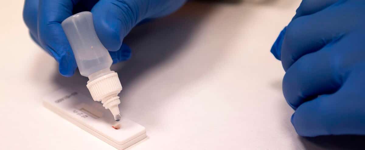 Les tests rapides sont arrivés au Saguenay | JDQ