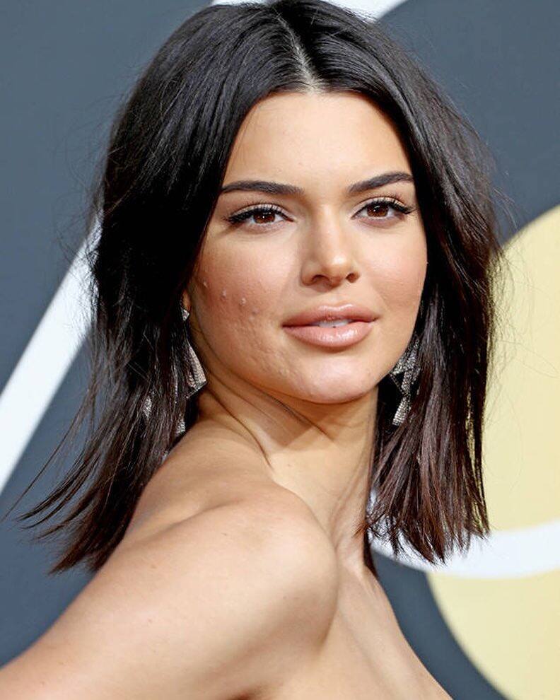 Voici La Signification De L Endroit Ou Tu As Des Boutons Dans Ton Visage Billie