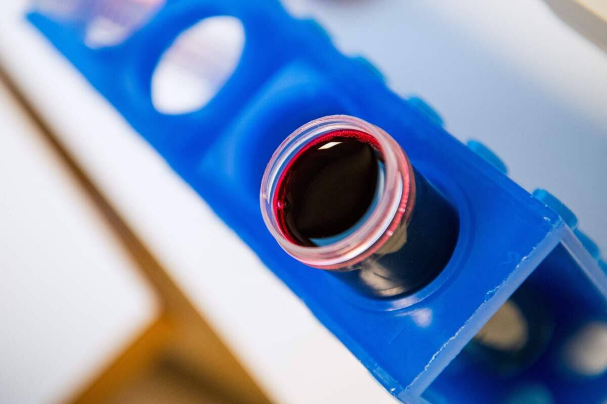 Du faux sang, nouvelle arme pour vaincre moustiques et paludisme