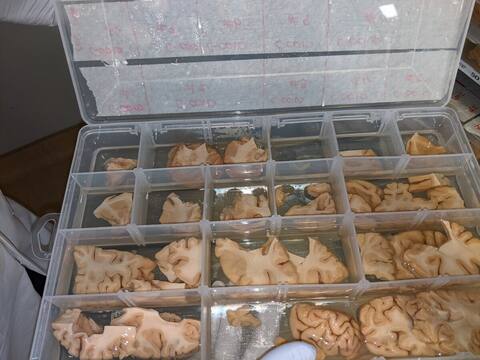 Depending on the determined method, the brains can be frozen or stored, as in the photo, at a temperature of 4 degrees Celsius.