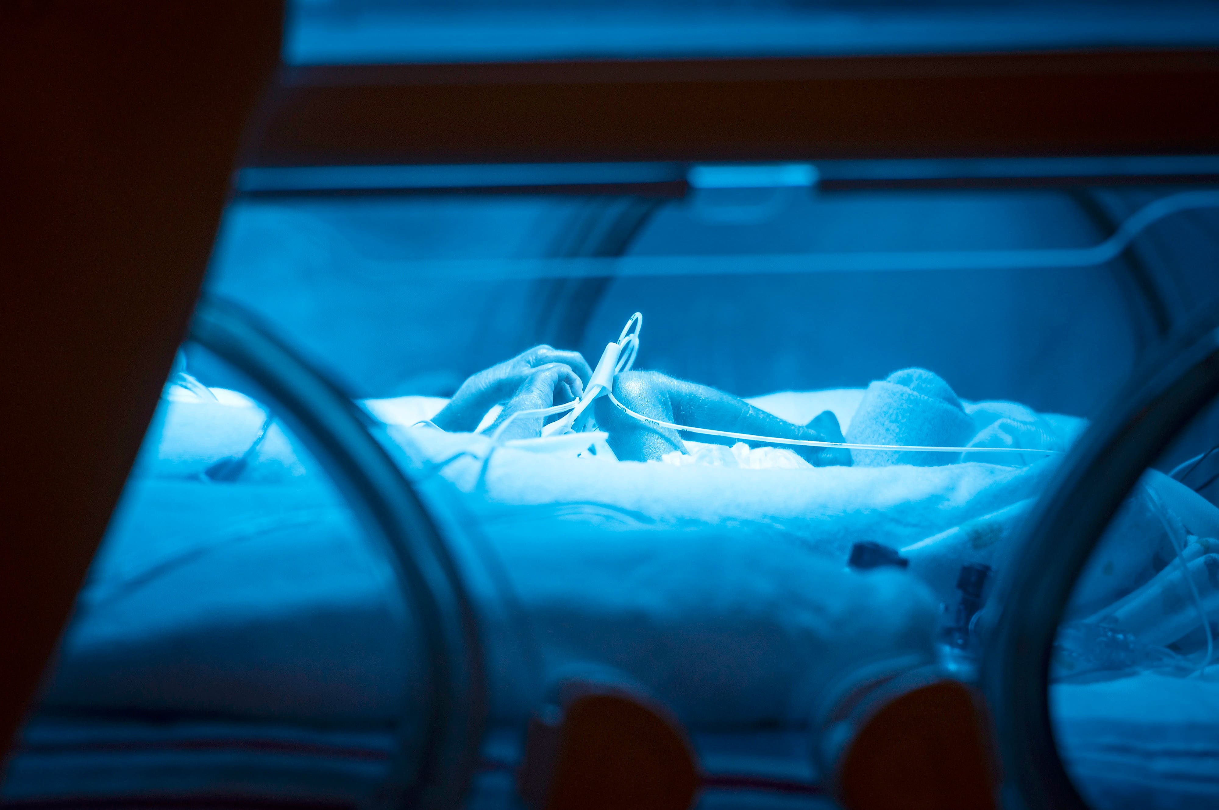 Bébés prématurés: Un test cérébral avec un simple capteur prédit le développement du cerveau