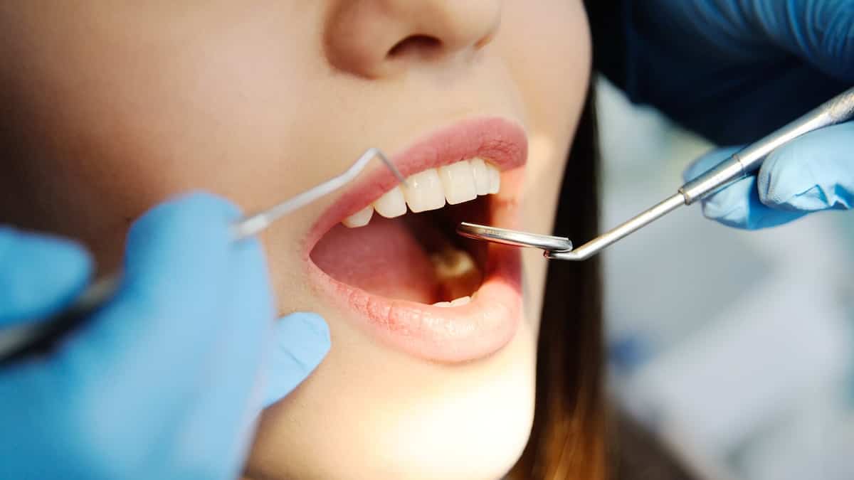 Prix des soins dentaires: suis-je condamnée à manger mou?