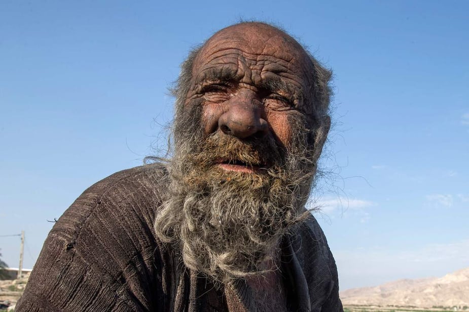 Image principale de l'article L'homme «le plus sale du monde» a rendu l'âme