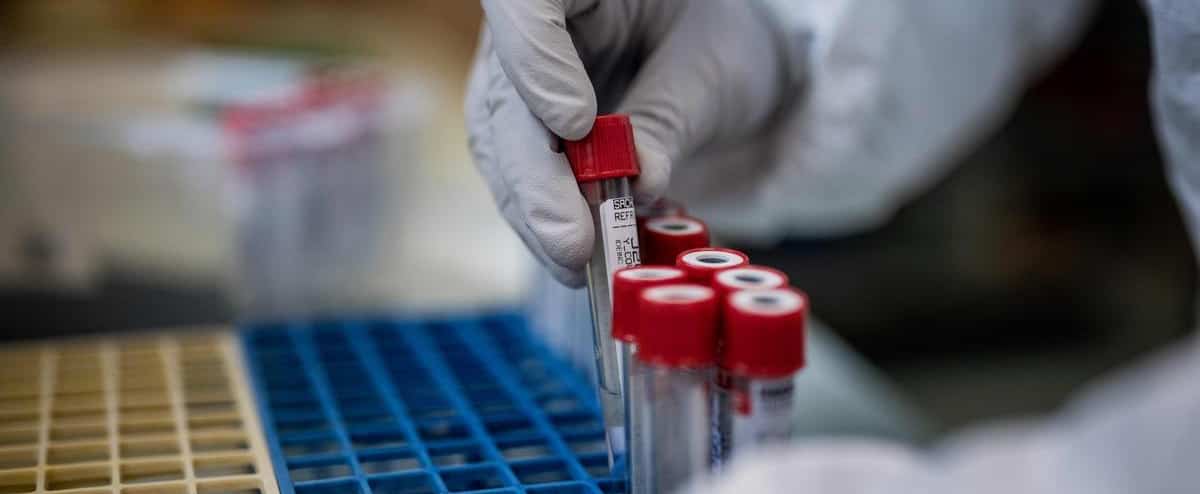 Treatments for COVID-19: some progress, no panacea 1