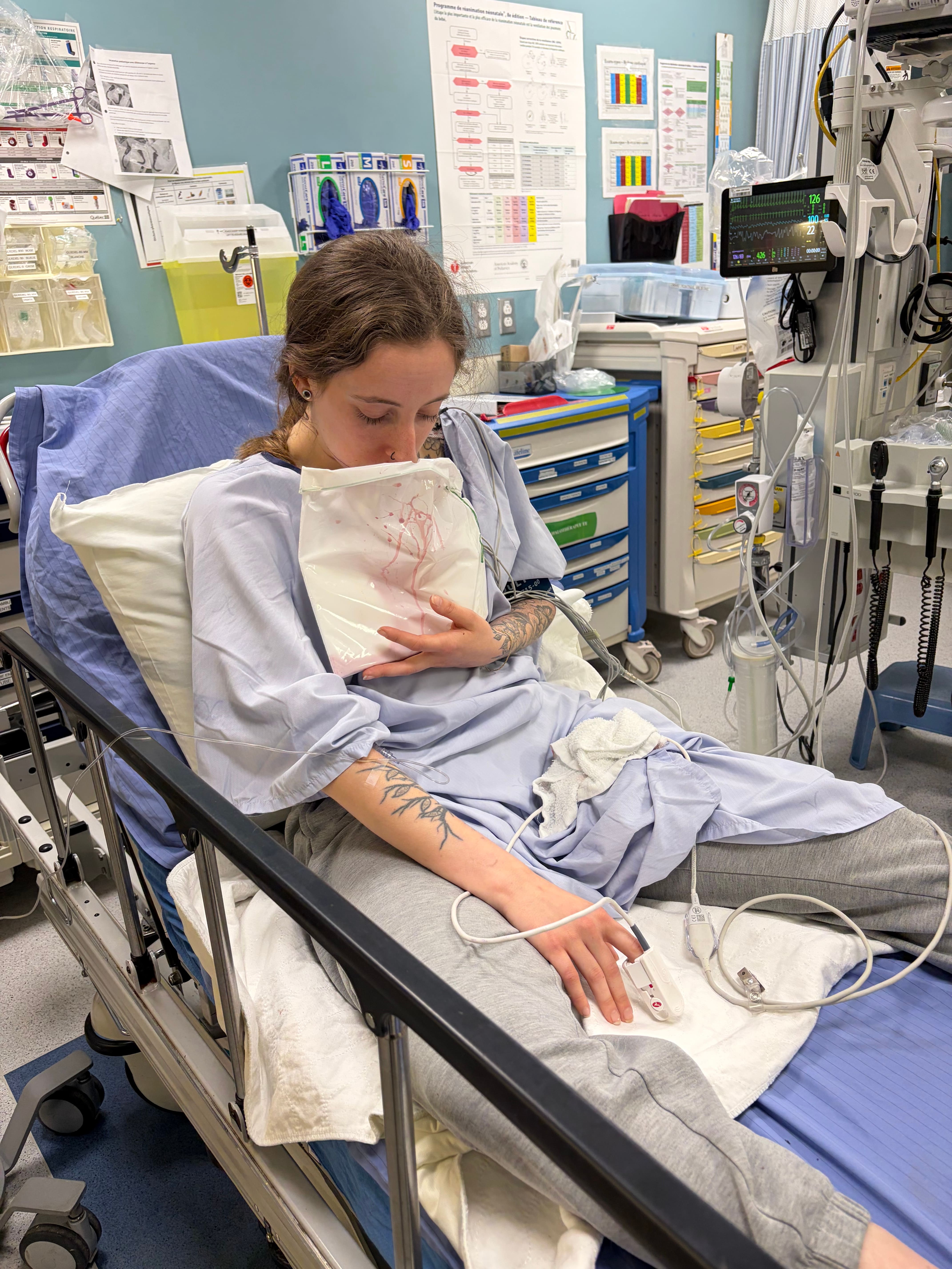 Chanel Plamondon a eu une grave hémorragie après l'ablation de ses amygdales et a dû être transportée d'urgence à l'hôpital de Granby, où ils ont réussi à cautériser la plaie.