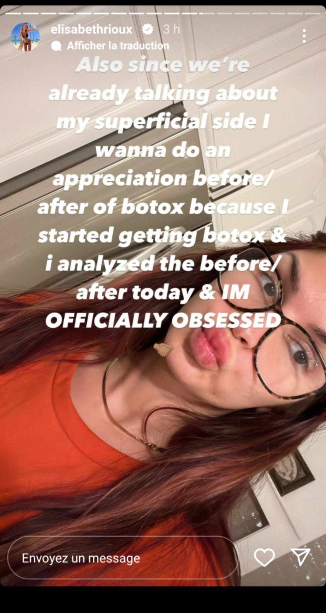 Elisabeth Rioux ose les injections de botox et le résultat est ...