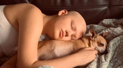 Twins show symptoms of cancer at the same time