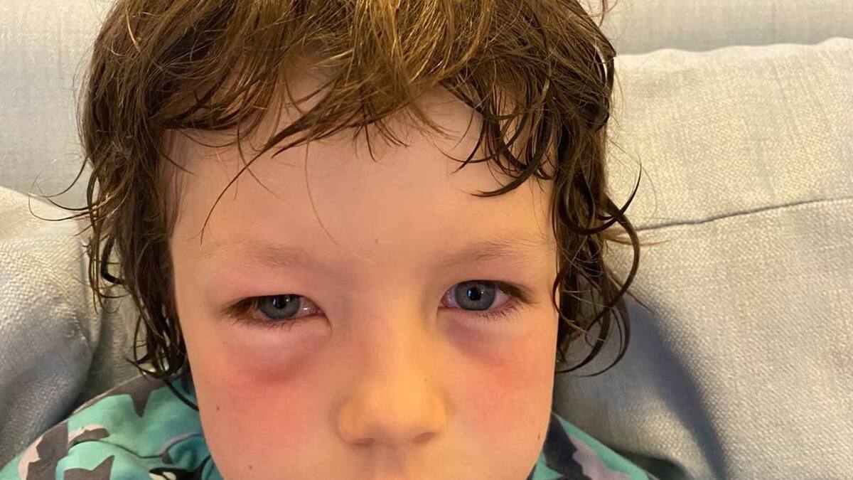 Yeux boursouflés: un touriste de 8 ans gazé par mégarde par des policiers à Paris