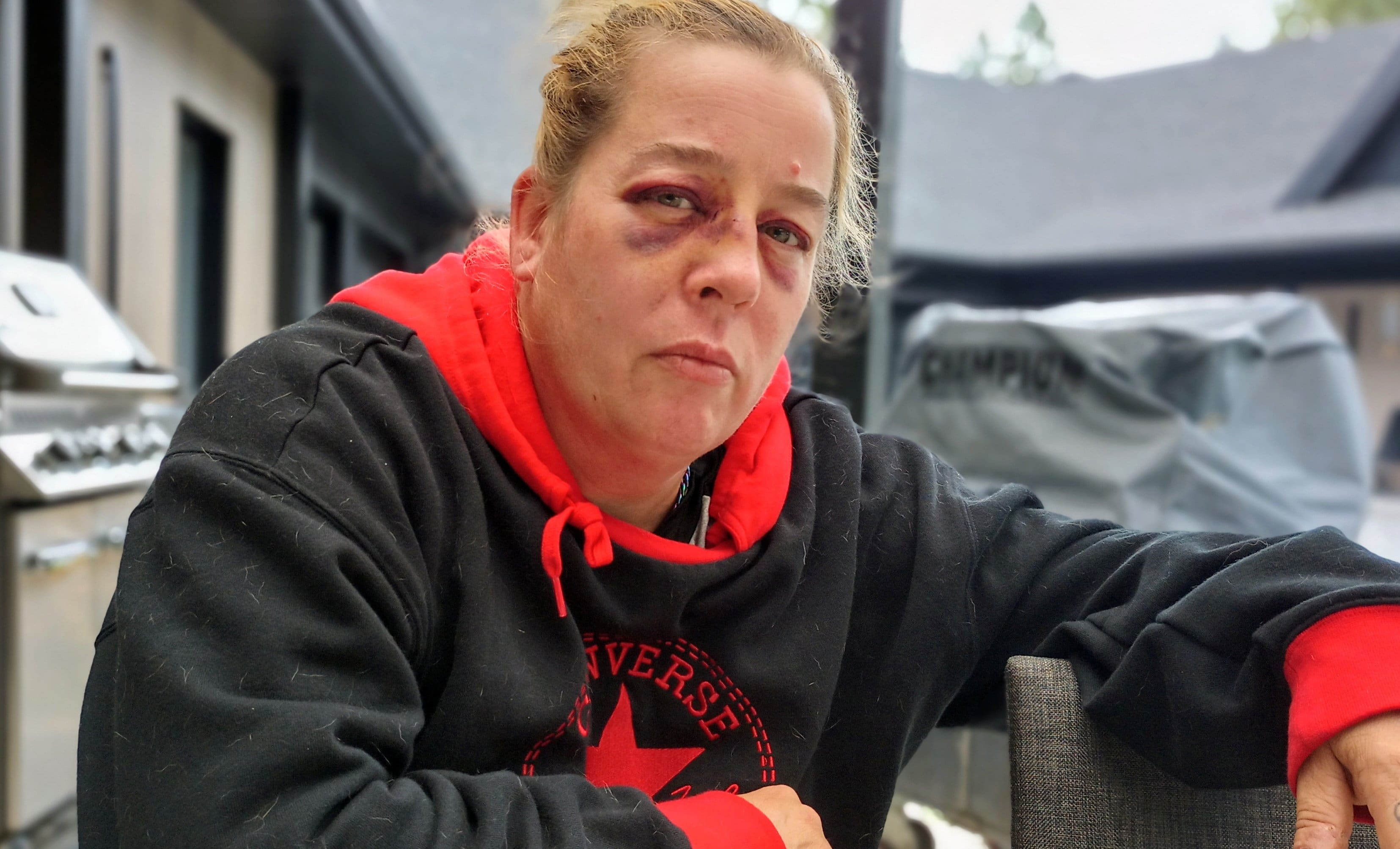 Patsy Van Damme, victime d’un patient violent dans un bloc psychiatrique.