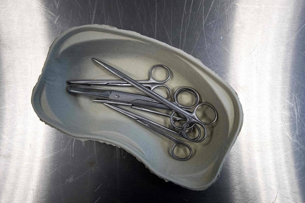 Une femme a v&eacute;cu 20 ans avec des ciseaux chirurgicaux dans son ventre