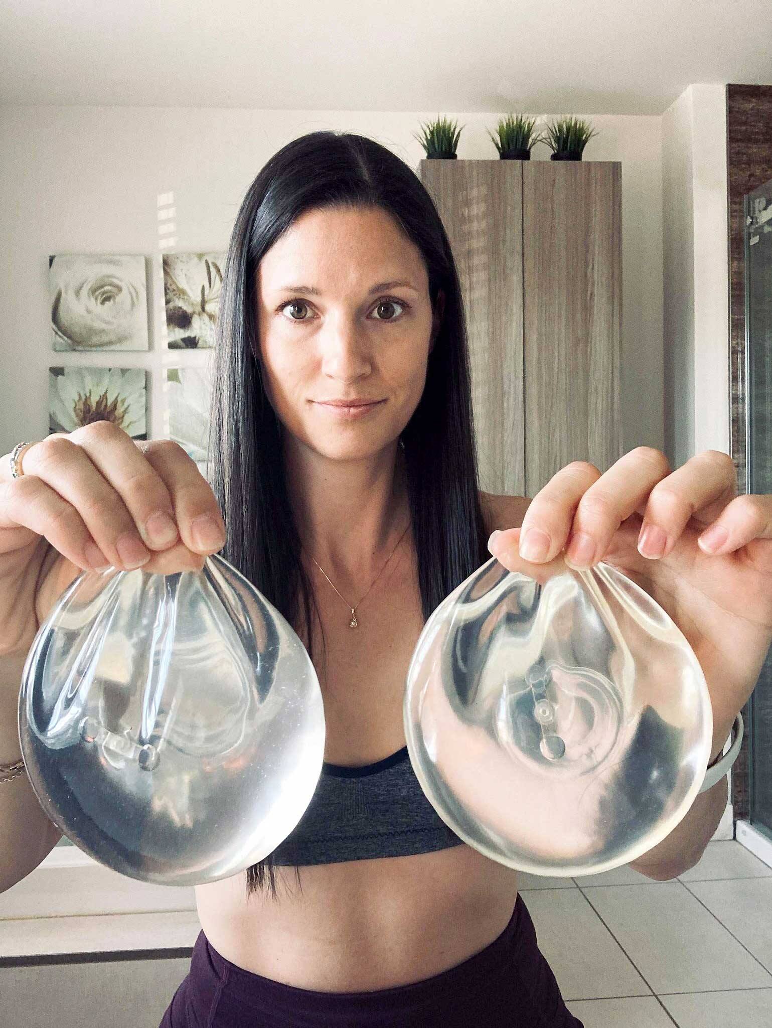 Leurs implants mammaires les auraient rendues malades | JDM