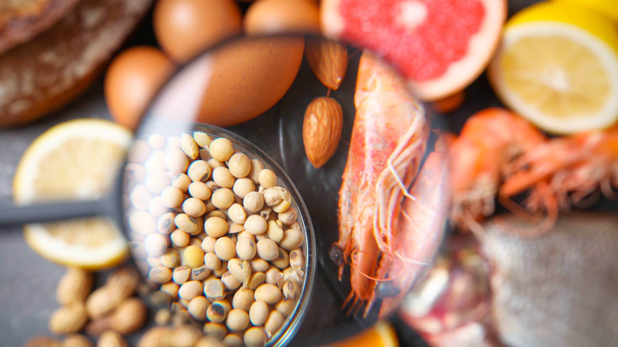 D&eacute;jouer les allergies alimentaires