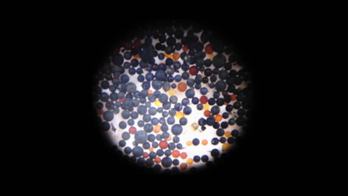 Des microplastiques dans le cerveau