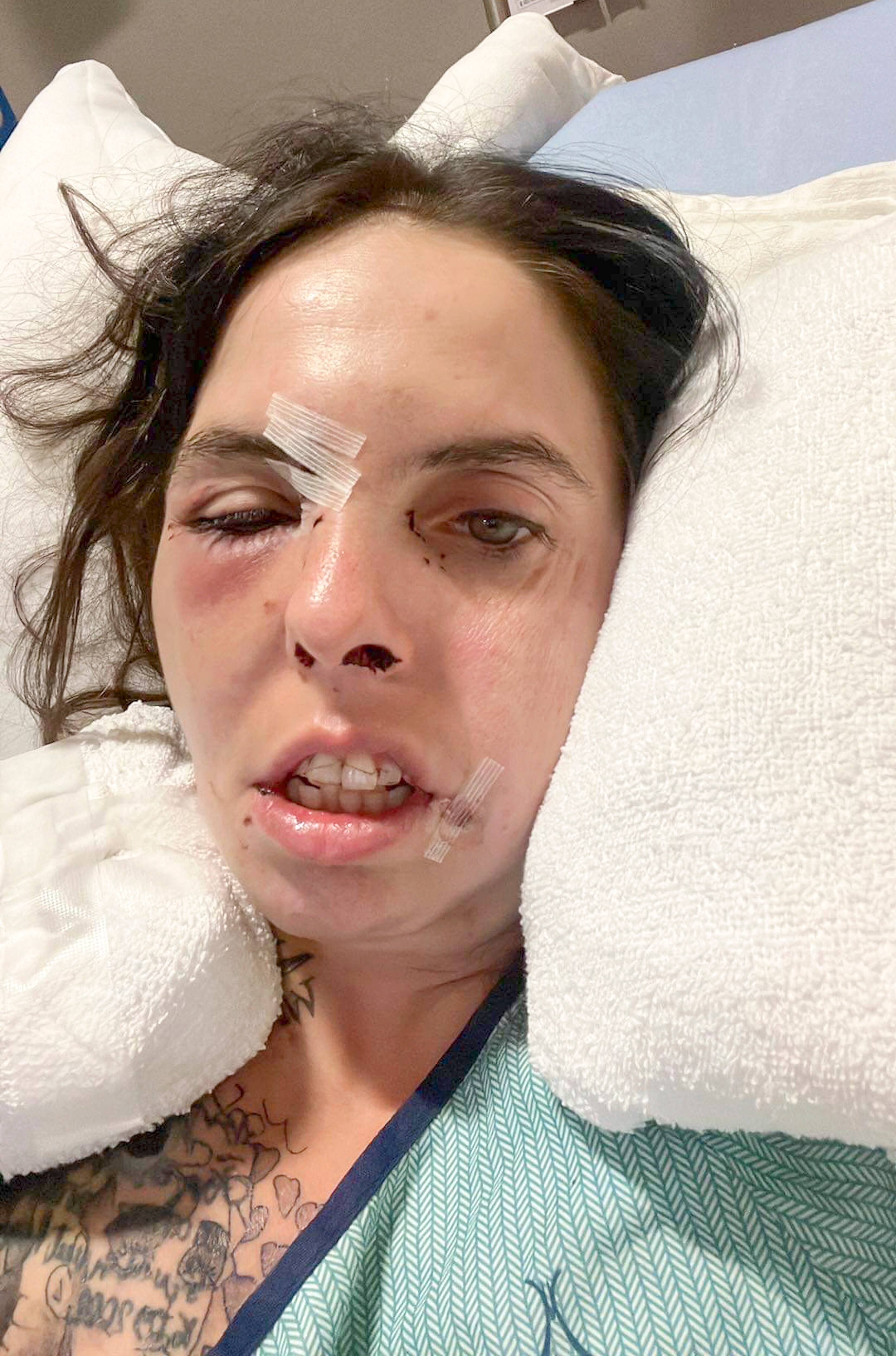 Violence conjugale: la victime d&rsquo;une tentative de meurtre perd sa garderie