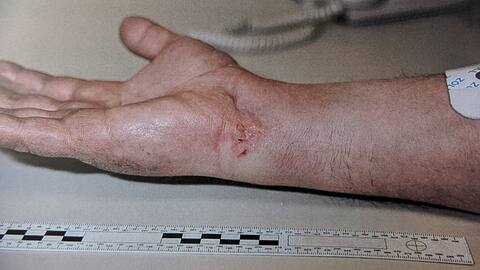 The victim had minor injuries to his hands, possibly caused by duct tape.