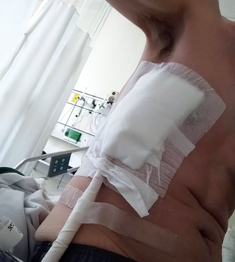 Bob Welch said he was seriously injured in an interaction with a police officer this summer and sought help first.