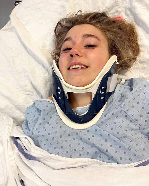 Maya Thomas, 14, is still smiling despite multiple injuries from the crash and facial injuries.