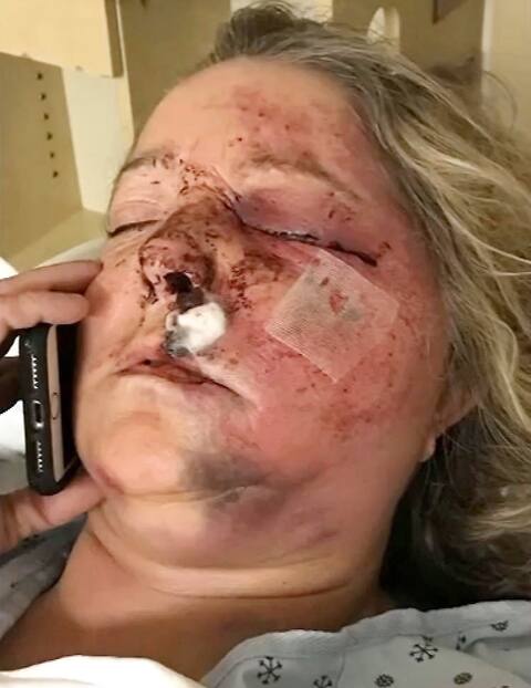 Accused of attempted murder, an angry snowmobiler must defend himself