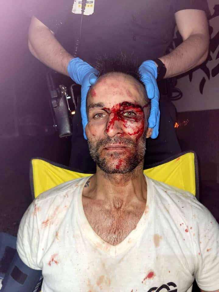 [EN IMAGES] &laquo;J&rsquo;&eacute;tais s&ucirc;r de mourir&raquo;, affirme un conducteur sauvagement tabass&eacute;