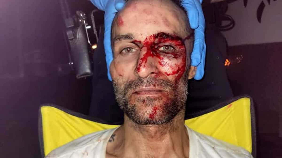 «J’étais sûr de mourir», affirme un bénévole sauvagement tabassé