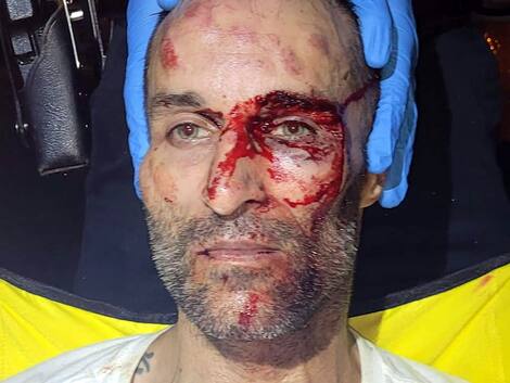 Christophe Côté - The beaten driver Christophe Côté - The beaten driver