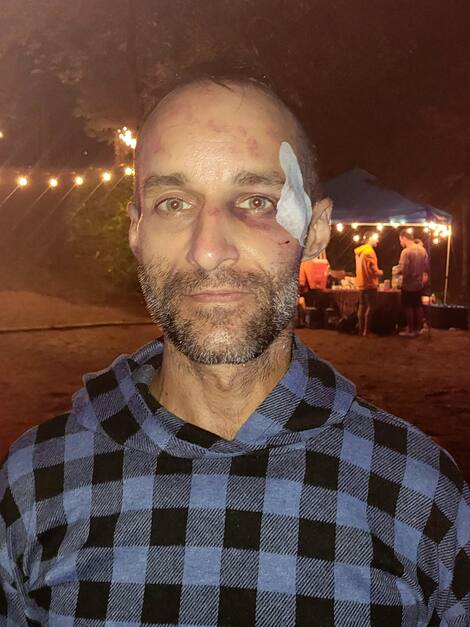 Christophe Côté - The beaten driver Christoph Cote was attacked on Saturday evening. Here he was released from the hospital on Sunday.