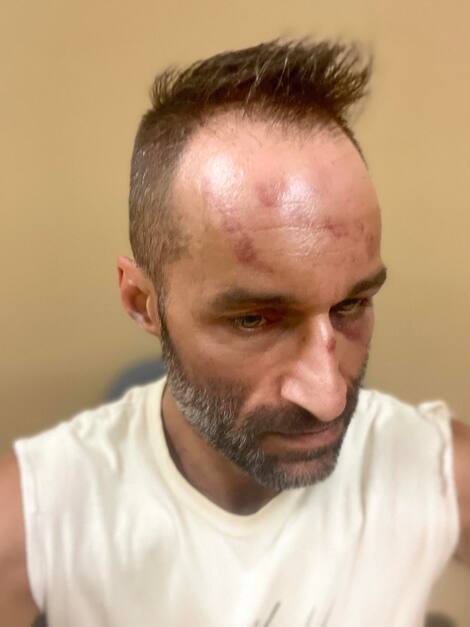 Christophe Côté - The beaten driver Christophe Cote was attacked two days later.