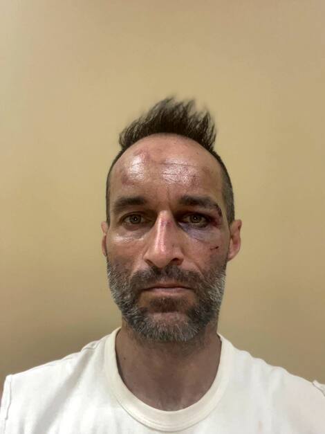 Christophe Côté - The beaten driver Christophe Cote was attacked two days later.