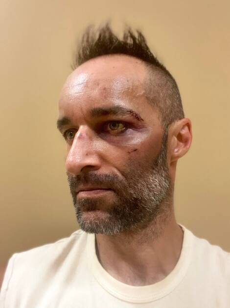 Christophe Côté - The beaten driver Christophe Cote was attacked two days later.