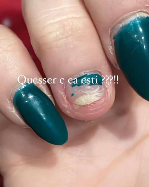 Gelcare - Manoir - Ongles