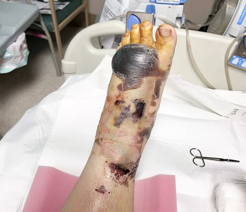 Isabelle Ouellet's left foot was also pierced by an iron bar during the collision.