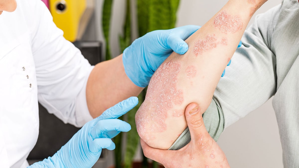 Évacuation d’un foyer en Normandie: le syndrome collectif inexpliqué derrière la crise